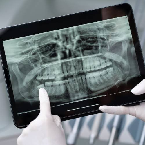 https://bhosaledentalclinic.com/wp-content/uploads/2024/06/DENTAL-X-RAY.jpg